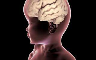 Симптомы и лечение наружной заместительной гидроцефалии головного мозга