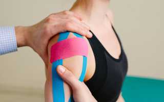 Укрепление и восстановление связок плечевого сустава