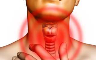 Гипертиреоз – симптомы и лечение, щитовидная железа у женщин