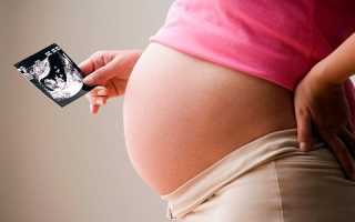 Симптомы и лечение цистита при беременности