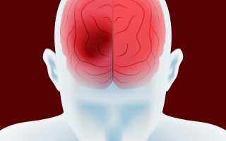 Энцефалопатия головного мозга – что это такое, лечение, симптомы